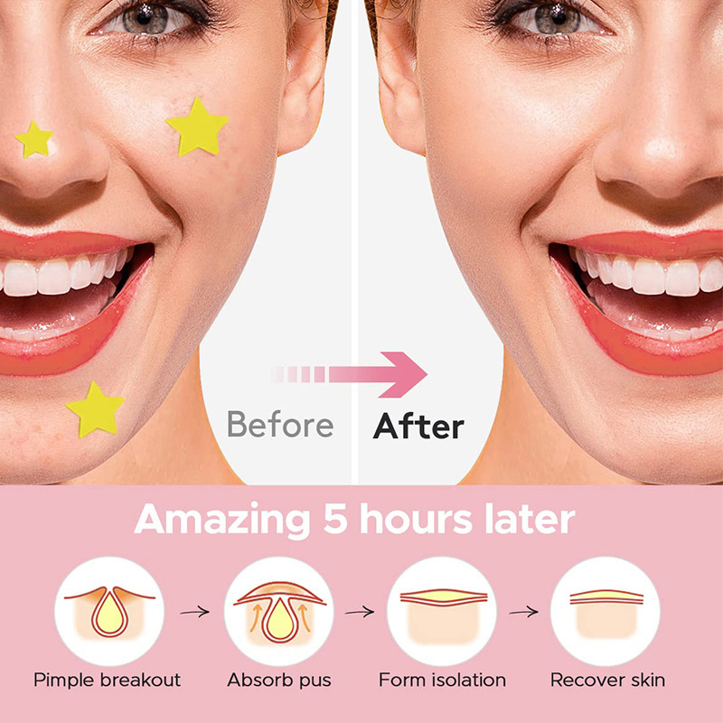แผ่นแปะสิวรูปดาว 600 ชิ้น/ชุด  - Beauty Of Makeup บทวิจารณ์และราคา